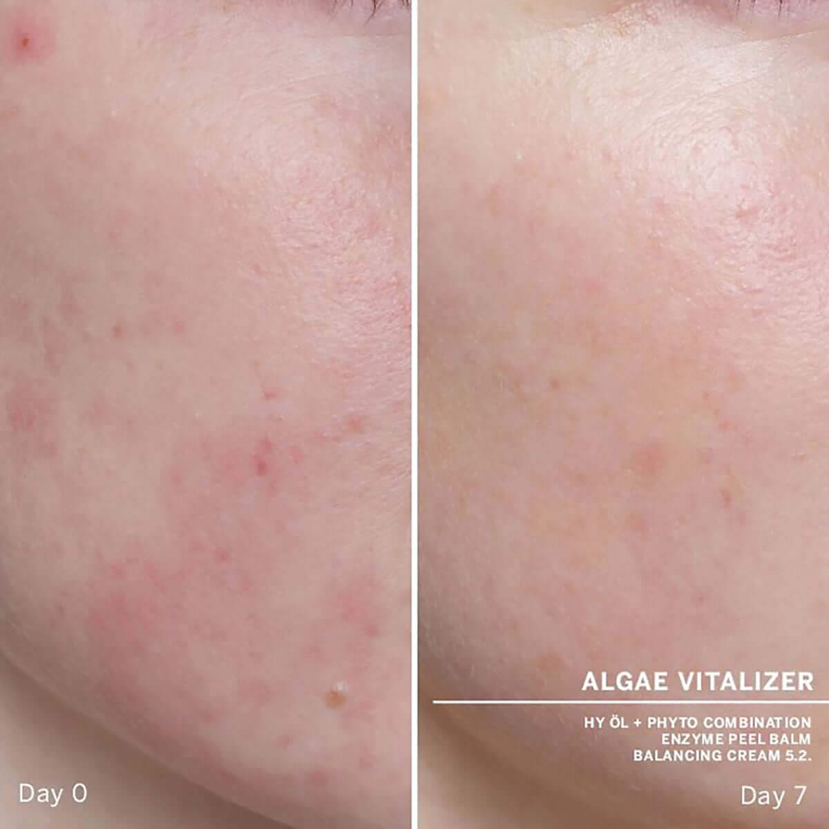 Babor AMPOULE Algae Vitalizer-Ansiktsserum-JKSHOP