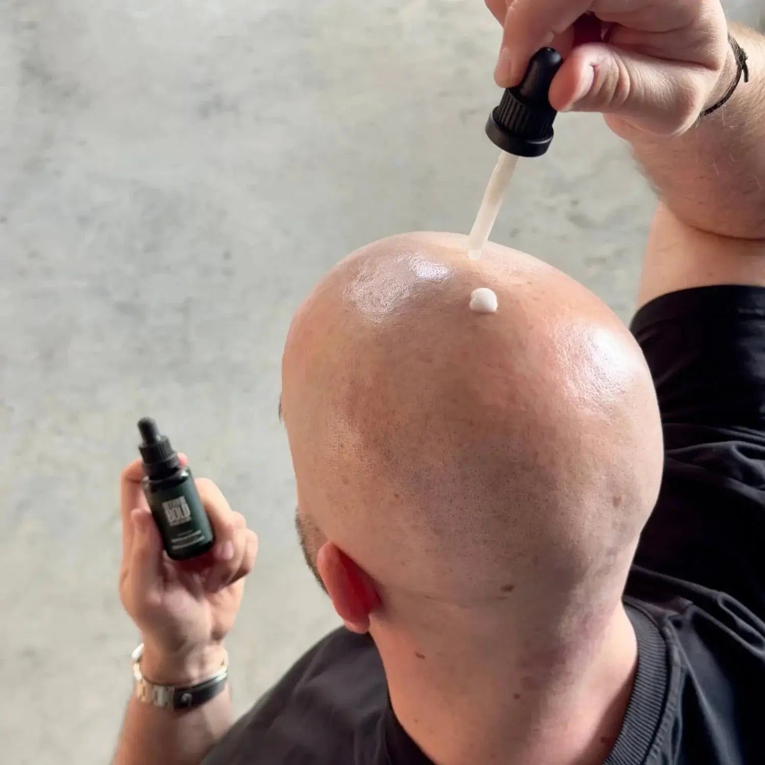 Better Be Bold, Anti-Pigment Bald Serum-Hodebunnspleie-JKSHOP