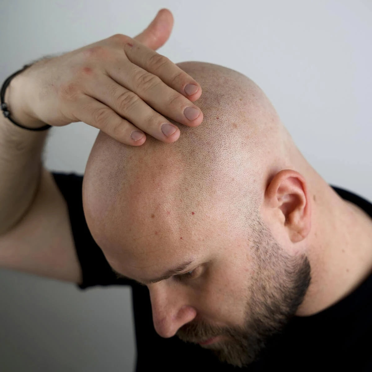 Better Be Bold Magic Bald Head & Beard Oil - Diamond Shine Effect - Ansiktsolje - JK-Shop