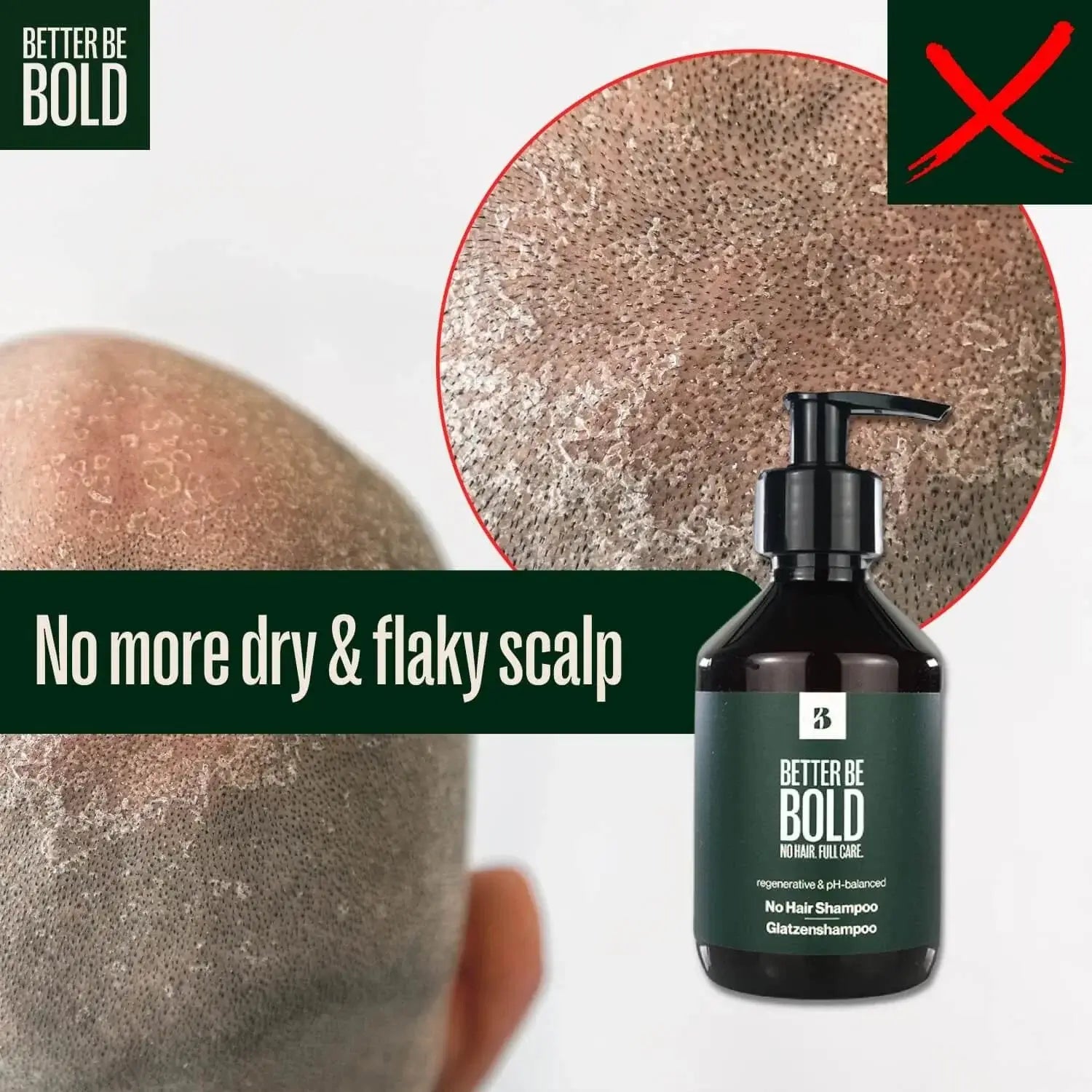 Better Be Bold, Moisturizing "No Hair" Shampoo-Sjampo-JKSHOP