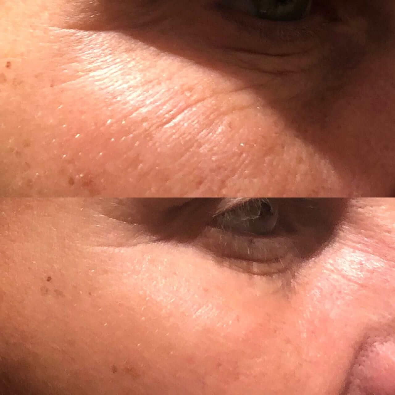 Casmara, Eye Perfection Pressotherapy Glasses-Øyemaske-JKSHOP