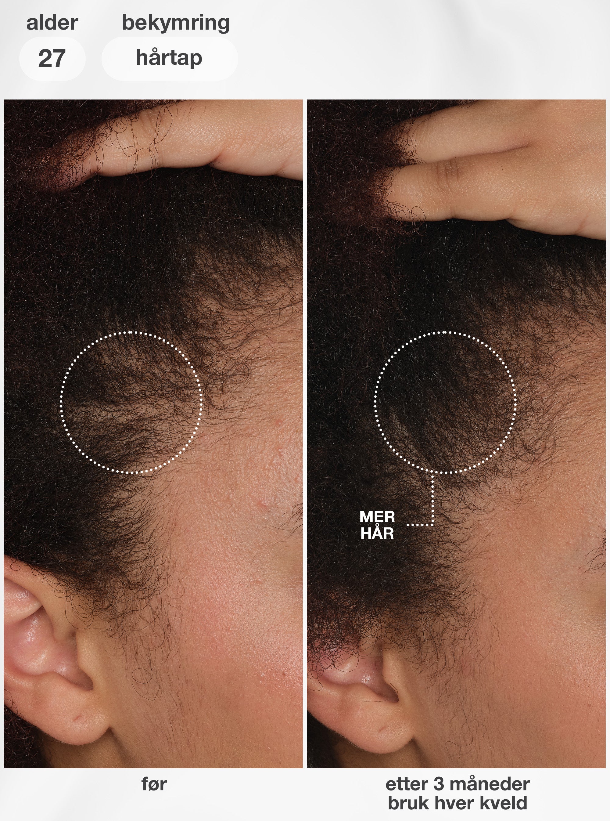 K18 FutureIQ Biomimetic Hair Longevity Serum