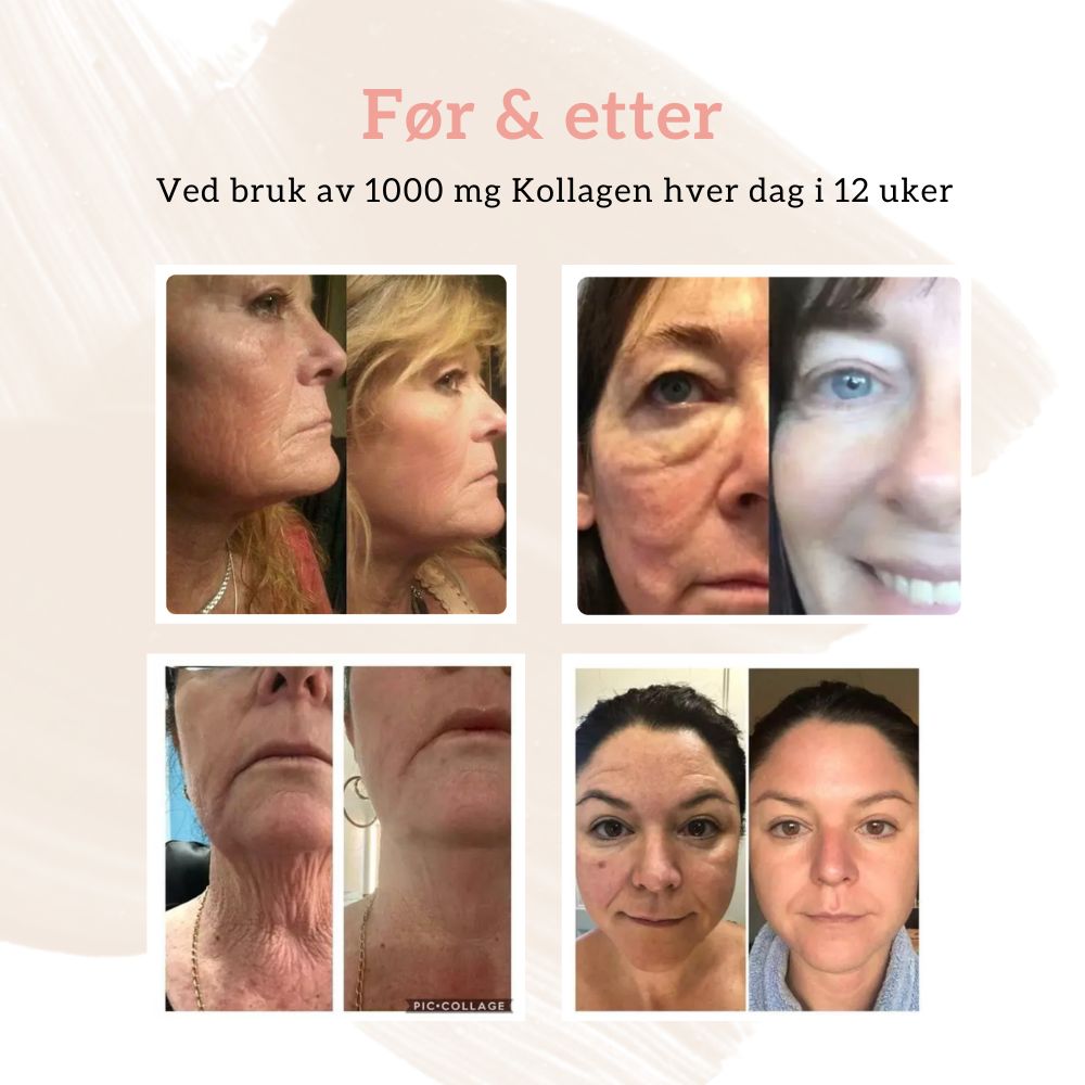 KOLLAGEN 2, HYALURONSYRE & FURUBARK - Vitaminer og kosttilskudd - JK-Shop
