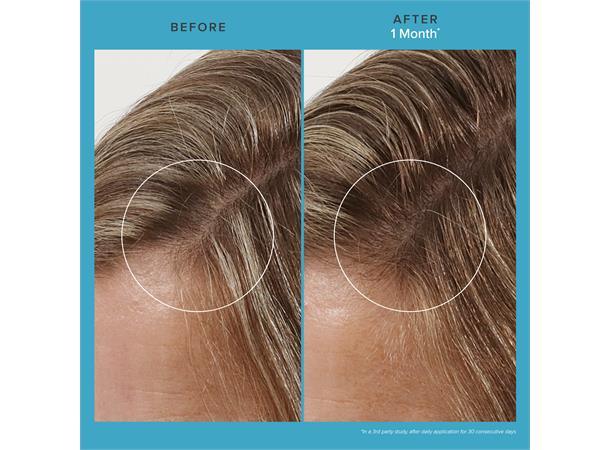 Living Proof Scalp Care Revitalizing Treatment-Hodebunnspleie-JKSHOP
