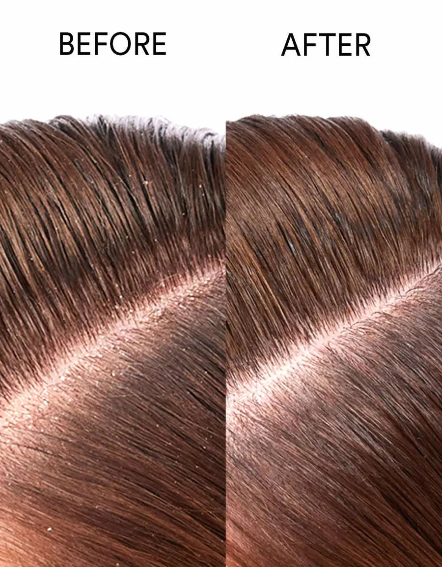 SM Natural Scalp Restoring Oil 30ml Pure Genius - Hårolje - JK-Shop