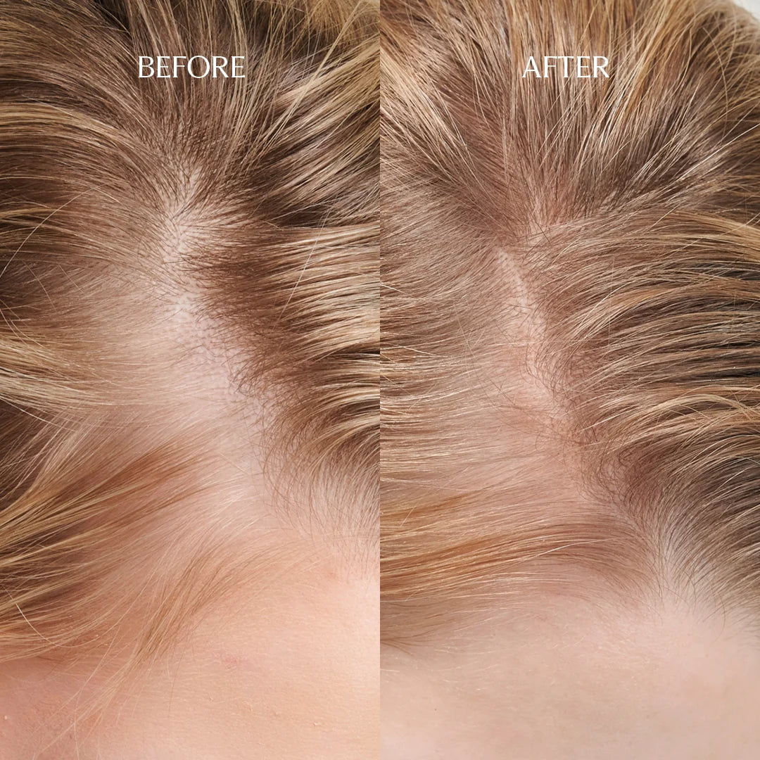 Under Your Skin Density Drops 30 ml - Hårserum - JK-Shop