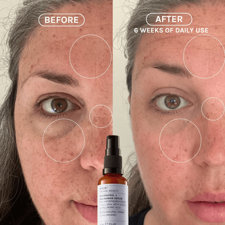 EVOLVE Resveratrol + Niacinamide Serum 30ml