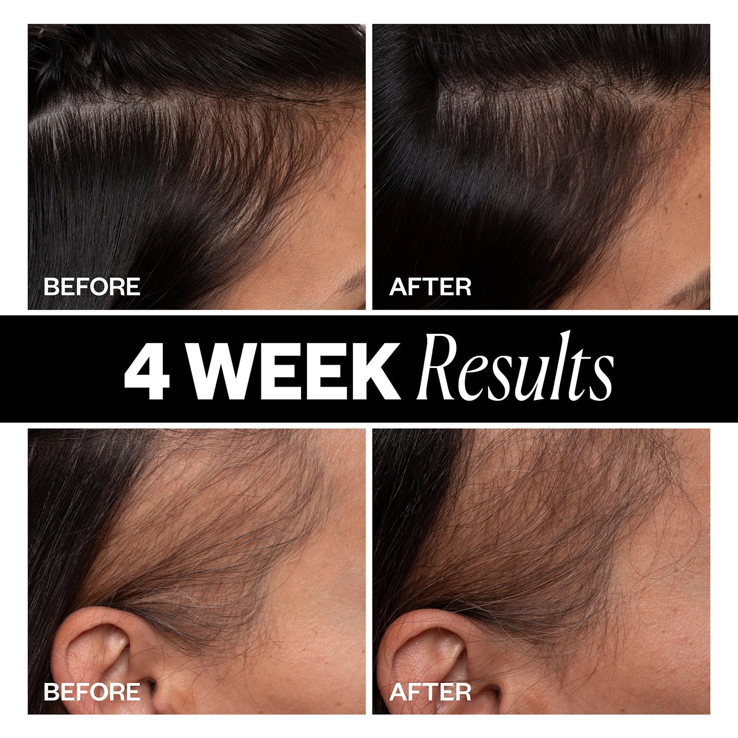 SPONSORED Hair Density Scalp Treatment