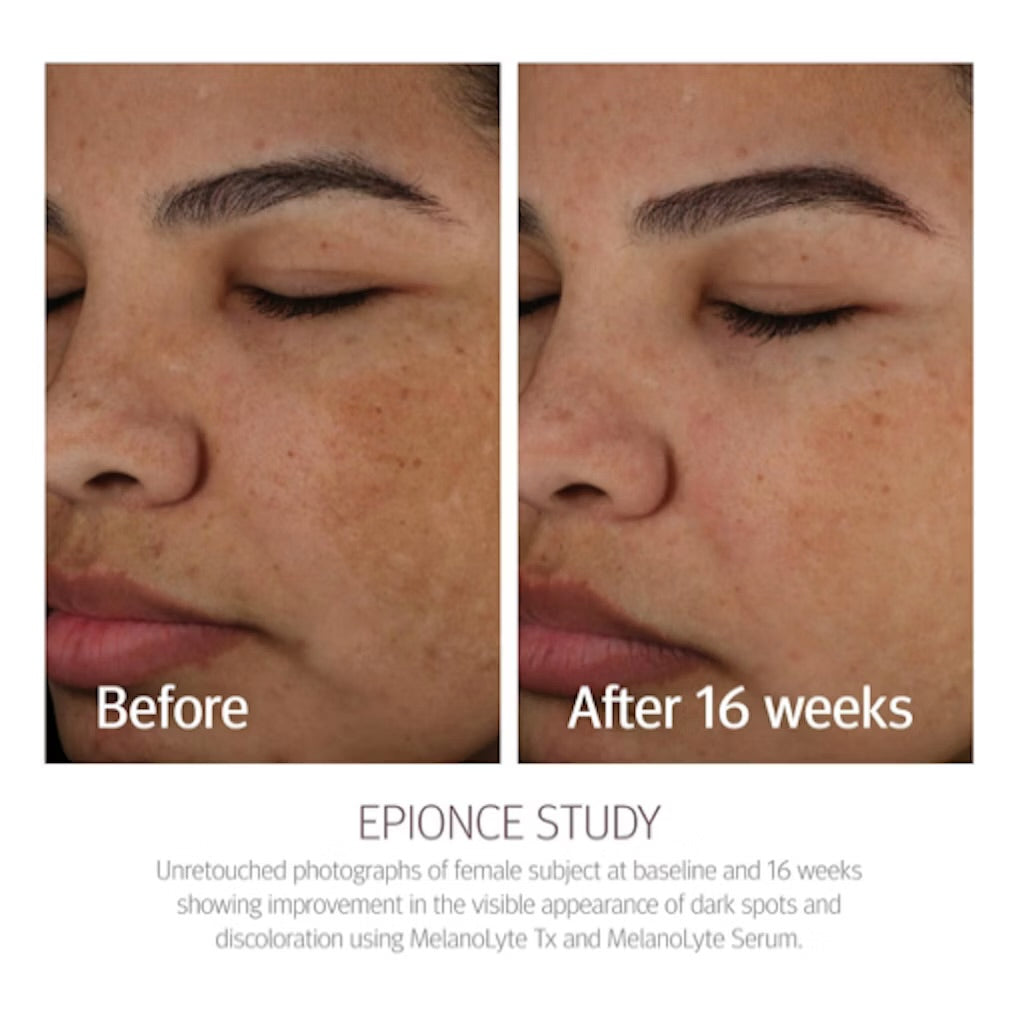 Epionce Melanolyte TX 30 ml - Cream, Moisturizer, Serum - JK-Shop