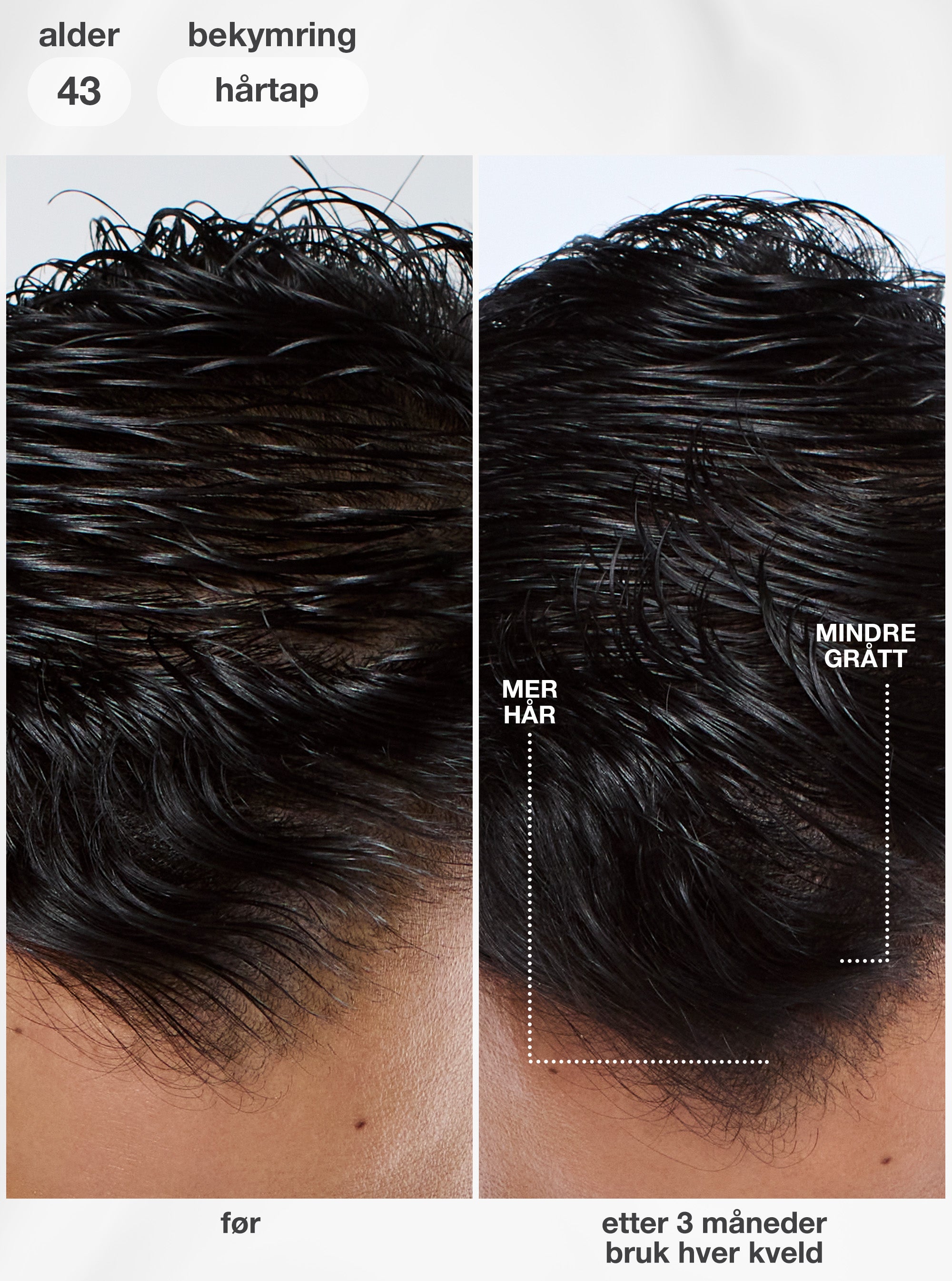 K18 FutureIQ Biomimetic Hair Longevity Serum
