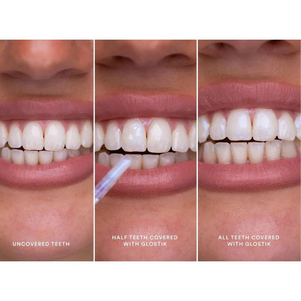 Hismile Glostik Tooth Gloss - Tannbleking - JK-Shop