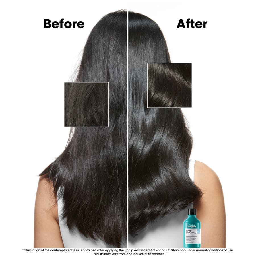 L’Oréal Anti-Dandruff Dermo-Clarifier Shampoo 300 ml